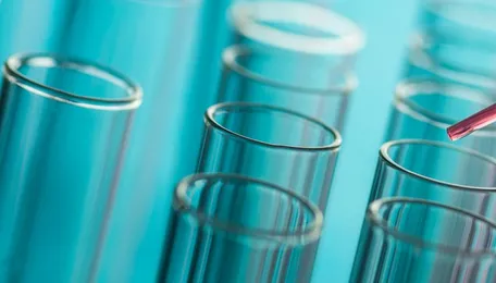 Sipchem reverses to loss on higher feedstock costs, lower selling prices
