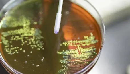 Pune Campaign Targets Rising Antimicrobial Resistance Risks