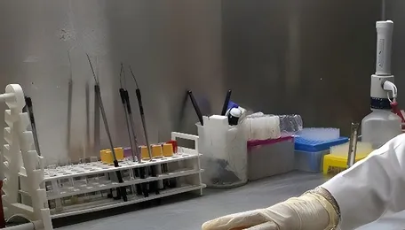 Hyderabad Antibiotic Resistant Bacteria Alarm