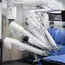 JJ Hospital Completes 301 Robotic Surgeries in 18 Months