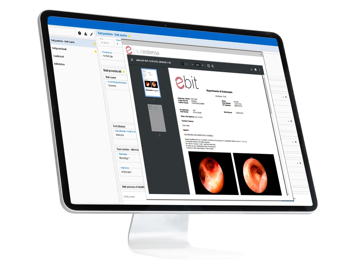 SUITESTENSA Endo Workflow Software | Buy Online