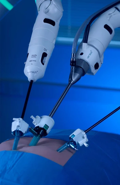 Versius Plus Surgical Robot | Buy Online